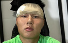 國安冬訓(xùn)激烈，方昊掛彩纏繃帶