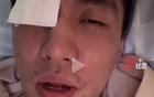 郭艾倫眼傷曝光，臺(tái)灣球員已道歉，專家警告可能失明。