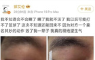 運動員怒斥隊友，指眼事件，維護尊嚴(yán)。